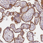 Immunohistochemical staining of human placenta shows strong cytoplasmic granular positivity in trophoblastic cells.