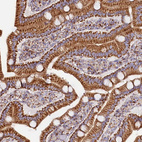 Immunohistochemical staining of human duodenum shows strong cytoplasmic granular positivity in glandular cells.