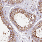 Immunohistochemical staining of human testis shows strong cytoplasmic granular positivity in cells in seminiferous ducts.