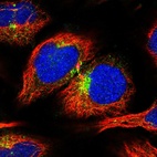 Immunofluorescent staining of human cell line U-2 OS shows localization to vesicles.