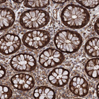 Immunohistochemical staining of human rectum shows strong cytoplasmic positivity in glandular cells.