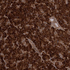 Immunohistochemical staining of human pancreas shows strong cytoplasmic positivity in exocrine glandular cells.