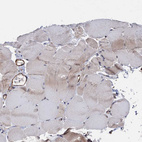 Immunohistochemical staining of human skeletal muscle shows negative to very weak cytoplasmic positivity in myocytes as expected.