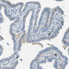 Anti-LGI2 Antibody