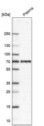 Anti-LGI2 Antibody