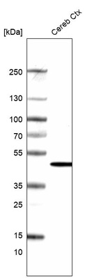 Anti-ADCYAP1R1 Antibody