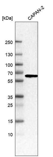 Anti-C1RL Antibody