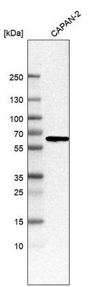 Anti-C1RL Antibody