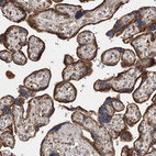 Anti-IARS2 Antibody