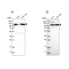 Anti-IARS2 Antibody