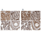 Anti-IARS2 Antibody