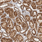 Anti-IARS2 Antibody