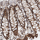 Anti-IARS2 Antibody