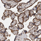 Anti-IARS2 Antibody