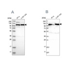 Anti-IARS2 Antibody