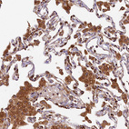 Anti-CLYBL Antibody