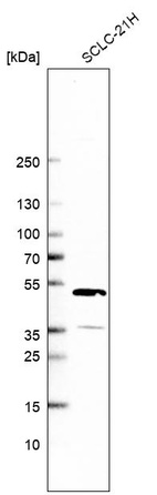 Anti-CLYBL Antibody