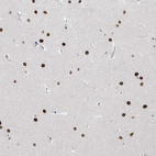 Immunohistochemical staining of human cerebellum shows strong nucleus-nucleus membranous positivity in molecular layer.