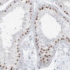 Immunohistochemical staining of human testis shows strong nucleus-nucleus membranous positivity in subset of cells in seminiferous ducts.