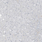 Immunohistochemical staining of human liver shows no positivity in hepatocytes as expected.