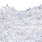 Immunohistochemical staining of mouse dorsal root ganglion shows strong nuclear immunoreactivity in single neurons.