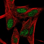 Anti-RORB Antibody