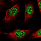 Anti-ZNF217 Antibody