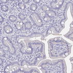 Anti-SYCP3 Antibody