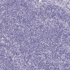 Anti-SYCP3 Antibody