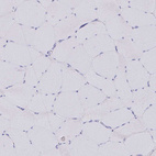 Anti-SYCP3 Antibody