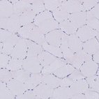 Anti-SYCP3 Antibody