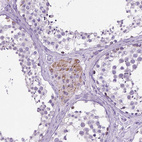 Anti-TMEM132E Antibody