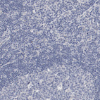 Anti-AK7 Antibody