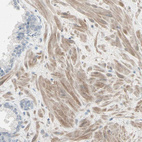 Anti-DMPK Antibody