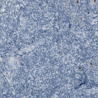 Anti-DMPK Antibody