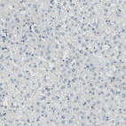 Anti-DMPK Antibody