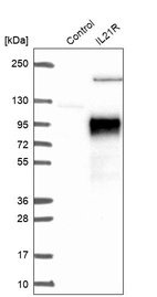 Anti-IL21R Antibody