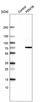 Anti-FEM1B Antibody