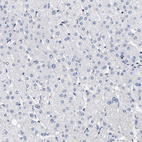 Anti-HSD17B1 Antibody