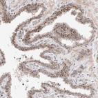 Anti-VPS28 Antibody