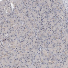 Anti-VPS28 Antibody