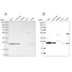 Anti-VPS28 Antibody