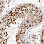 Anti-C1orf21 Antibody