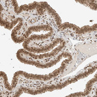 Anti-C1orf21 Antibody