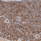 Anti-FRMD8 Antibody