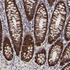 Anti-FRMD8 Antibody