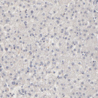 Anti-FRMD8 Antibody