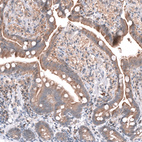 Anti-FOCAD Antibody