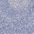 Anti-GPR143 Antibody