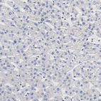 Anti-GPR143 Antibody